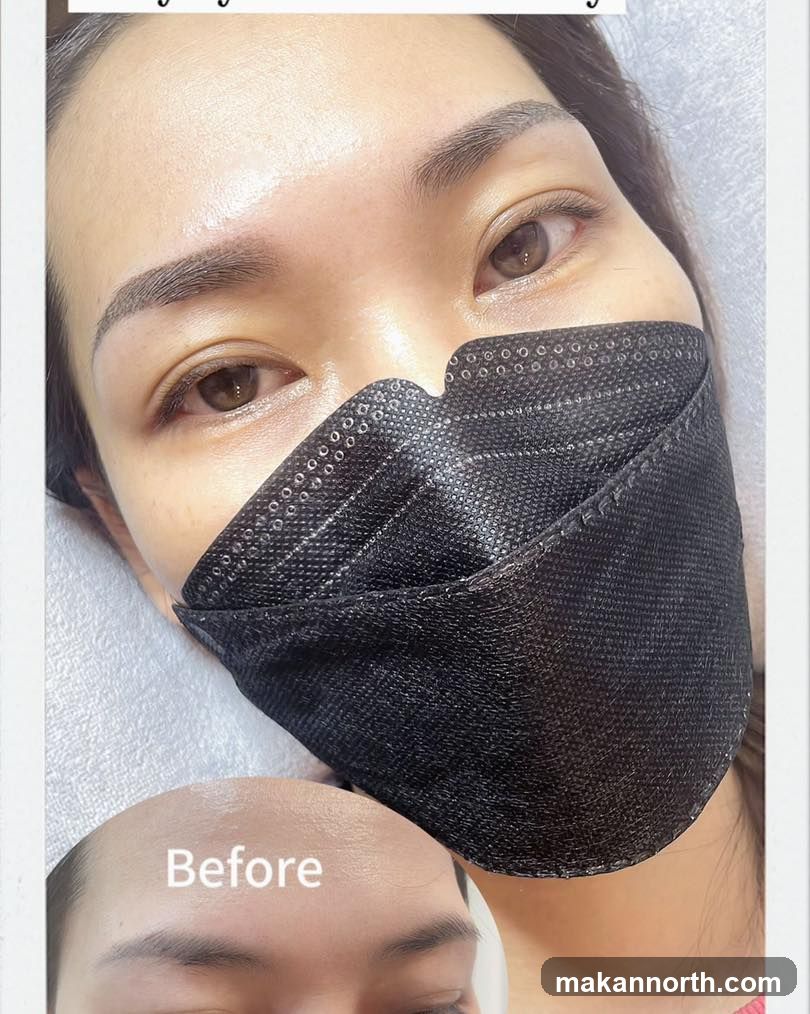 Eyebrow Enhancement Before and After